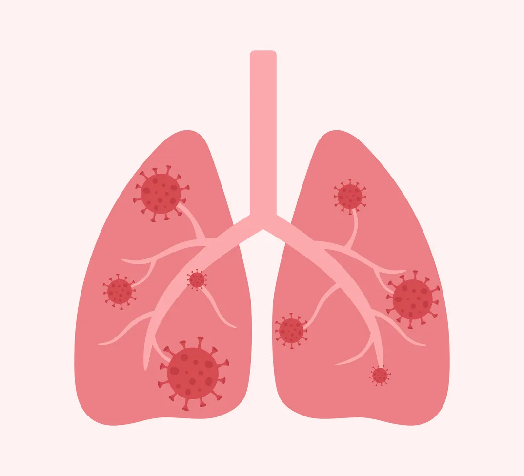 upper-respiratory-infections-in-kids-kidsstreet